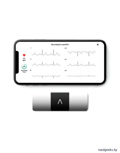 Умный электрокардиограф AliveCor KardiaMobile 6L EKG для iOS/Android